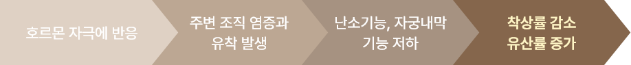 자궁내막증 단계이미지